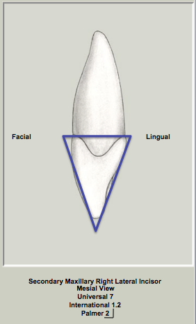 Mx Lateral Proximal Triangular.png